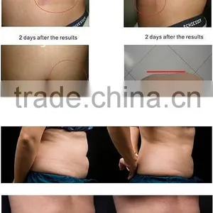 Best Multi Functional Machine With Tool New Chinese Slimming Equipment thumbnail-2
