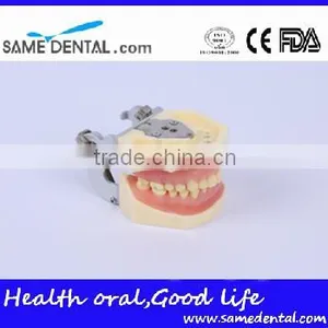 Dental Moderate Periodontal Disease Model Teaching Demonstration thumbnail-1