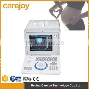 2016 New Digital Portable Ultrasound Scanner With High Quality and Low Price thumbnail-1