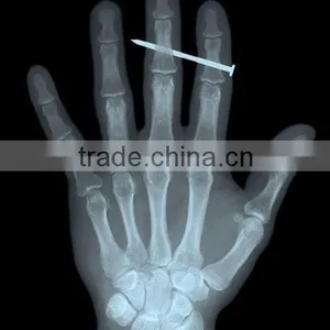 China KND-A/F CE Medical x Ray Film Hand x Ray thumbnail-1