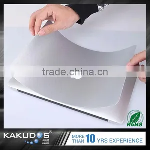 Wholesale Custom Waterproof Adhesive Protective Laptop Sticker for Macbook Pro 15 Retina thumbnail-3