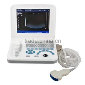 Carejoy Laptop Ultrasound Machine Ultrasound Scanner With Convex Probe RUS-9000F2 by CE ISO Approved thumbnail-4