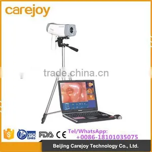 CE Certificate Electronic Digital Video Colposcope for Gynecology With Tripod thumbnail-1