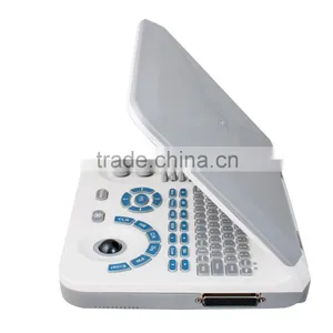 On Sale Low Price Large Screen 10.4 Inch Notebook/Laptop Ultrasound Scanner Machine With Probe--RUS-9000F2 thumbnail-3