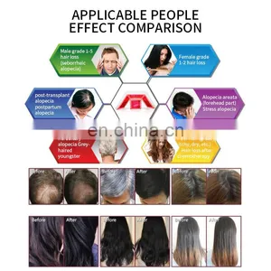 650nm Diode Laser SPA Scalp Treatment Machine With Hair Analysis Camera Professional Hair Regrowth Machine for Hair Salon thumbnail-5