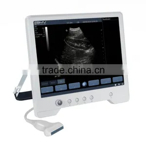 B&W Touch Screen Ultrasound Scanner/machine TS20 thumbnail-2