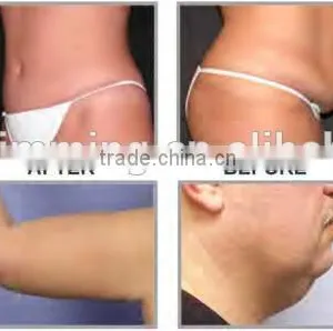 Quick Slim! Home Use Lipo Laser Slimming Machine With FDA Approved thumbnail-6
