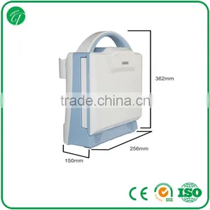 Hospital Equipment Laptop Ultrasound Machine/portable Ultrasound Scanner KX5600 thumbnail-5