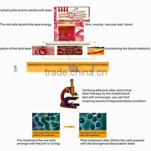 Made in China New Beautiful Machine Watch Instrument Phototherapy Device thumbnail-3