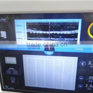 1229-631(factory Direct) Hifu Europe Senma Hifu Hifu4.5-2s thumbnail-3