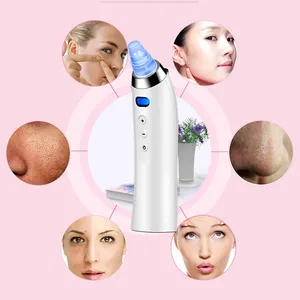 Home Use Electric Vacuum Pore Cleaner With 1-Year Warranty and Storage Case thumbnail-1