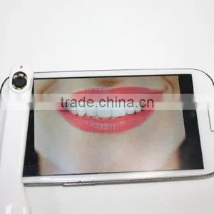 Original 720P Dental Medical Wifi Intra Oral Camera Full hd Oral Camrea Mini Usb Camera thumbnail-2