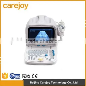 Factory Price !!CE Approved Portable Ultrasound Scanner With 3.5Mhz Multi-frequency Convex Probe RUS-9000A thumbnail-1