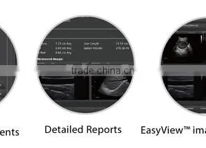 Hot Selling Portable Color Doppler Ultrasound Chison Eco5 Price thumbnail-6