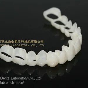 CAD/CAM PMMA Resin Clip on Veneers, Snap-on-veneers, Smile Veneers, Laboratoire Dentaire, Dentallabor, Laboratorio Dental, Dental Laboratory, Shenzhen LJ Dental Lab China thumbnail-2