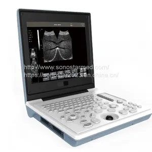 SS-6B Laptop All-Digital Ultrasound thumbnail-4