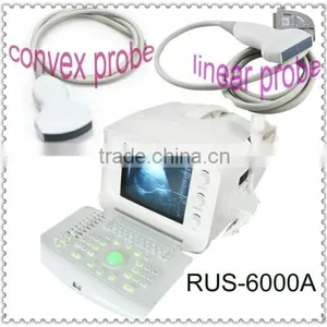 Full Digital Portable Ultrasound Scanner With Convex Linear Probe RUS-6000A Ultrasonic Machine Medical Factory thumbnail-1