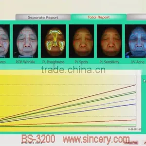 2014 Latest Magic Mirror System 3d Skin Analyzer thumbnail-4