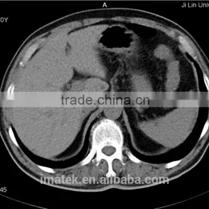 Inkjet Ink for Medical Image thumbnail-1