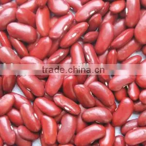 Supply Hot Sale English Red Kidney Beans With Competitive Price thumbnail-6