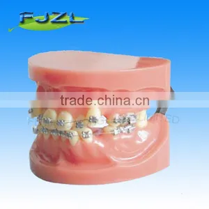 Orthodontic Teeth Model(malocclusion Teeth)/dental Orthodontic Models thumbnail-1