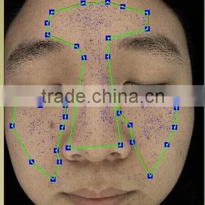UV Light Skin Scope Face Skin Test Machine thumbnail-5