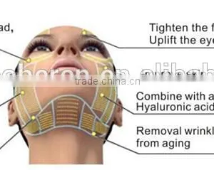 2016 Wrinkle Removal Slimming Portable Beauty Hifu thumbnail-4