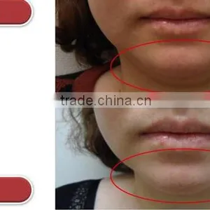 Portable New 2016 Hot Sale Hifu Anti-aging High Frequency Machine For Acne Skin Care Ultrasound Face Lift Machine Face Lifting thumbnail-6