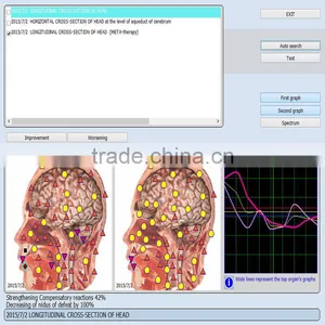 Meridian Digital Body Fat Analyzer 9D NLS Automotive Diagnostic Device thumbnail-6