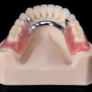 The Telescopic Crown Precision Attachment Denture Has Strong Stability thumbnail-1