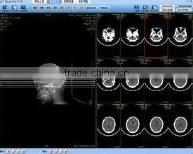Konida Medical X-ray Film Blue Film Dry Image Thermal Fuji Dry Film thumbnail-1
