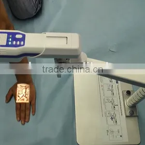 Good Price Easy Operate Medical Injection Portable Projection Vein Finder thumbnail-5