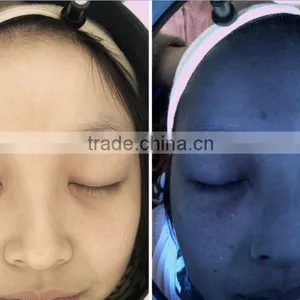 Langdy Facial Skin Analysis Machine Factory Direct Selling Price With CE thumbnail-2