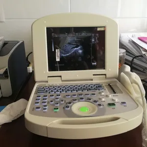 All Digital Ultrasonic Diagnosis SystemPortable Digital Acoustic Diagnostic Scanner for Human in Hospital thumbnail-4