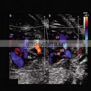 Mei Qing Medical X-ray Laser Film thumbnail-1