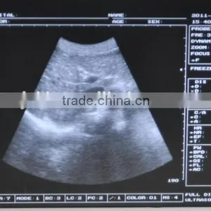 CE Approved Laptop/Portable Ultrasound Scanner With 3.5Mhz Multi-frequency Convex Probe thumbnail-2