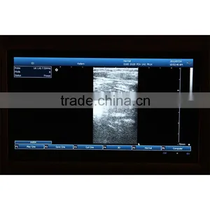 10.4 Inch LCD Laptop Ultrasound Machine PC System 3.5Mhz Convex Probe 7.5MHz Linear Probe Portable Ultrasound Scanner Price thumbnail-5