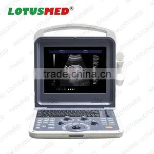 Cheap Portable 4d Color Doppler Ultrasound Price thumbnail-1