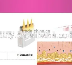 Hi Frequency Facial Machine Hifu/high Intensity Eye Lines Removal Focused Ultrasound/hifu Machine Professional High Frequency Machine thumbnail-6