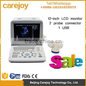 Carejoy Portable Ultrasound Machine Ultrasounic Scanner With 3.5Mhz Convex Probe RUS-9000B With CE ISO Mark thumbnail-1