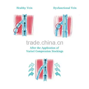 Anti-Embolism Stockings VAE-5 VAE-6 thumbnail-4