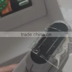 High Intensity Focus Ultrasound HIFU for Face and Neck Lift Without Surgery thumbnail-6