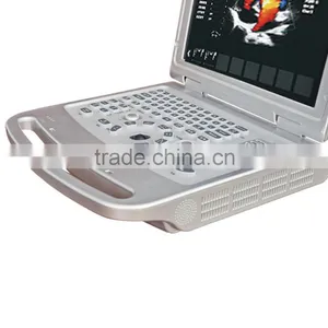15 Inch Laptop Color Doppler 64G Image-storage Capacity Ultrasound Scanner for Hospital thumbnail-3
