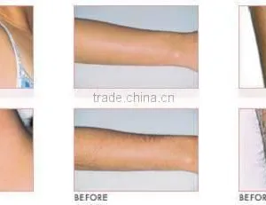 HOT Low Price Depitime Hair Removal/virgin Hair Removal/cheapest IPL Hair Removal thumbnail-6