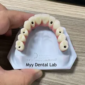 Digital-Crowns-Bridges Chinese Dental Lab Denture thumbnail-4