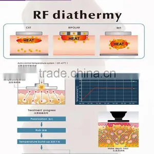 Luxury Best rf Equipment thumbnail-6