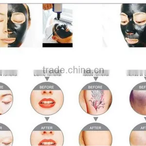Nice Appearance AYJ-317 nd Yag Q Switch Laser Beauty Equipment thumbnail-6