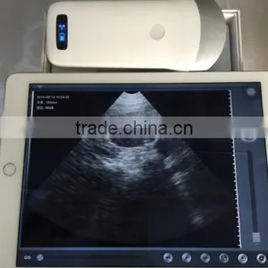Excellent Portable Wireless Ultrasound Transducers for Sale -WBU01 thumbnail-5