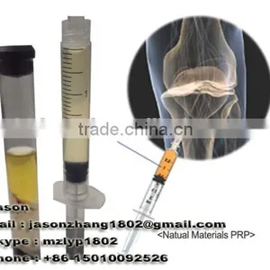 High Concentrate Platelet Price Plasma Centrifugation Prp Kit thumbnail-3