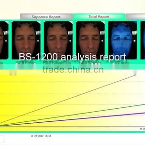 Beauty Salon 3d Magic Mirror For Skin Analyser thumbnail-6